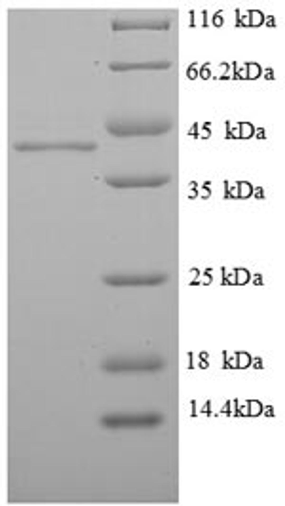 (Tris-Glycine gel) Discontinuous SDS-PAGE (reduced) with 5% enrichment gel and 15% separation gel.