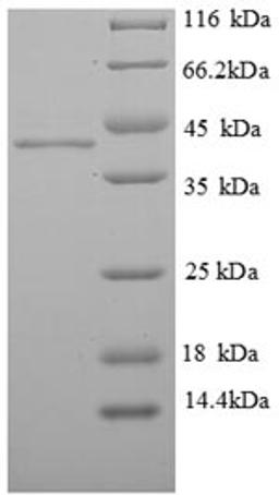 (Tris-Glycine gel) Discontinuous SDS-PAGE (reduced) with 5% enrichment gel and 15% separation gel.