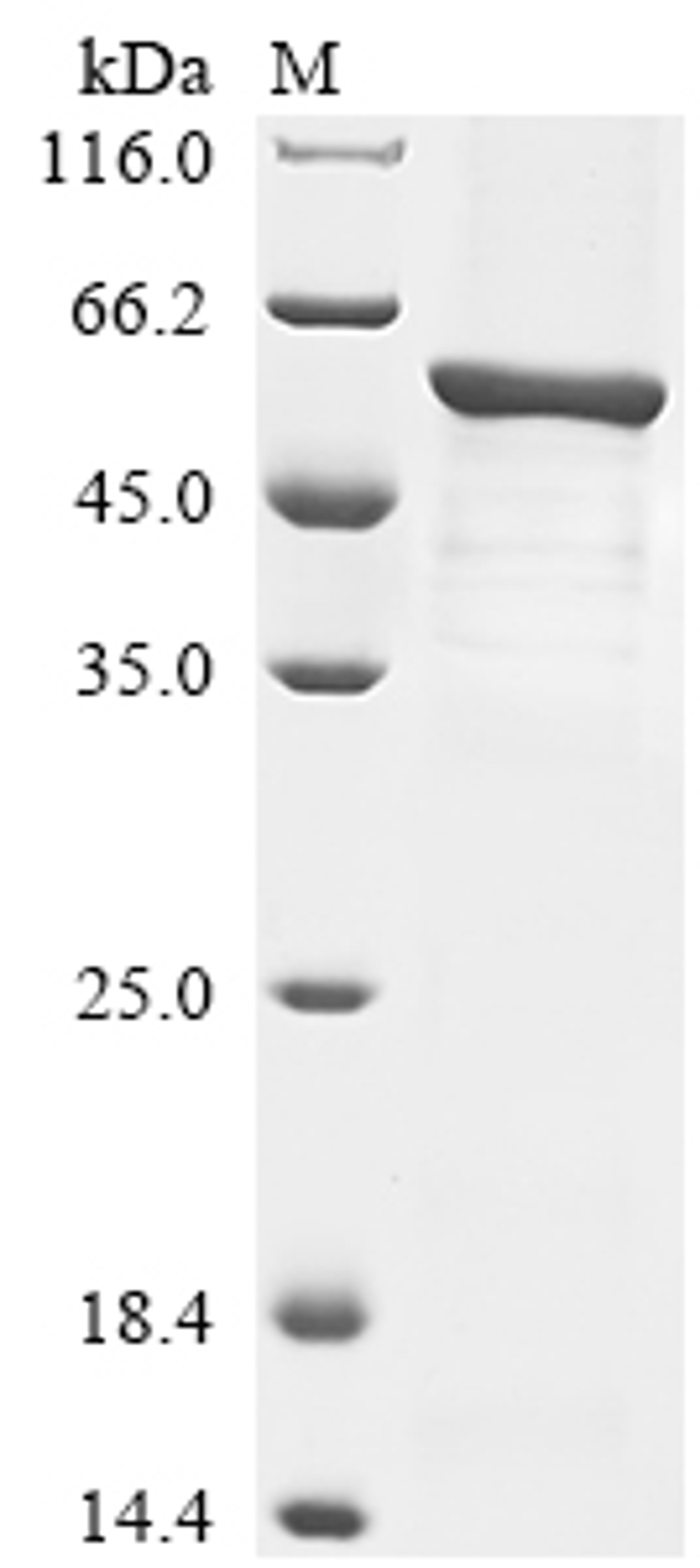 (Tris-Glycine gel) Discontinuous SDS-PAGE (reduced) with 5% enrichment gel and 15% separation gel.
