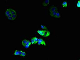Immunofluorescent analysis of MCF-7 cells using CSB-PA009456LA01HU at dilution of 1:100 and Alexa Fluor 488-congugated AffiniPure Goat Anti-Rabbit IgG(H+L)