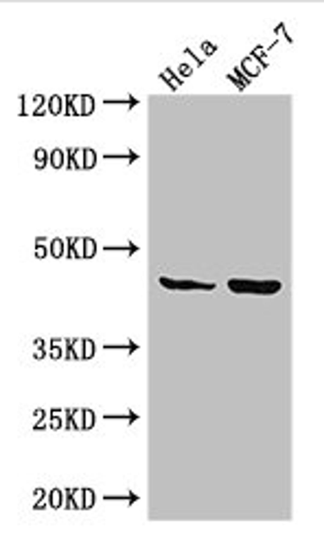 Western Blot. Positive WB detected in: Hela whole cell lysate, MCF-7 whole cell lysate. All lanes: MAP2K4 antibody at 3.25ug/ml. Secondary. Goat polyclonal to rabbit IgG at 1/50000 dilution. Predicted band size: 45, 46 kDa. Observed band size: 45 kDa.