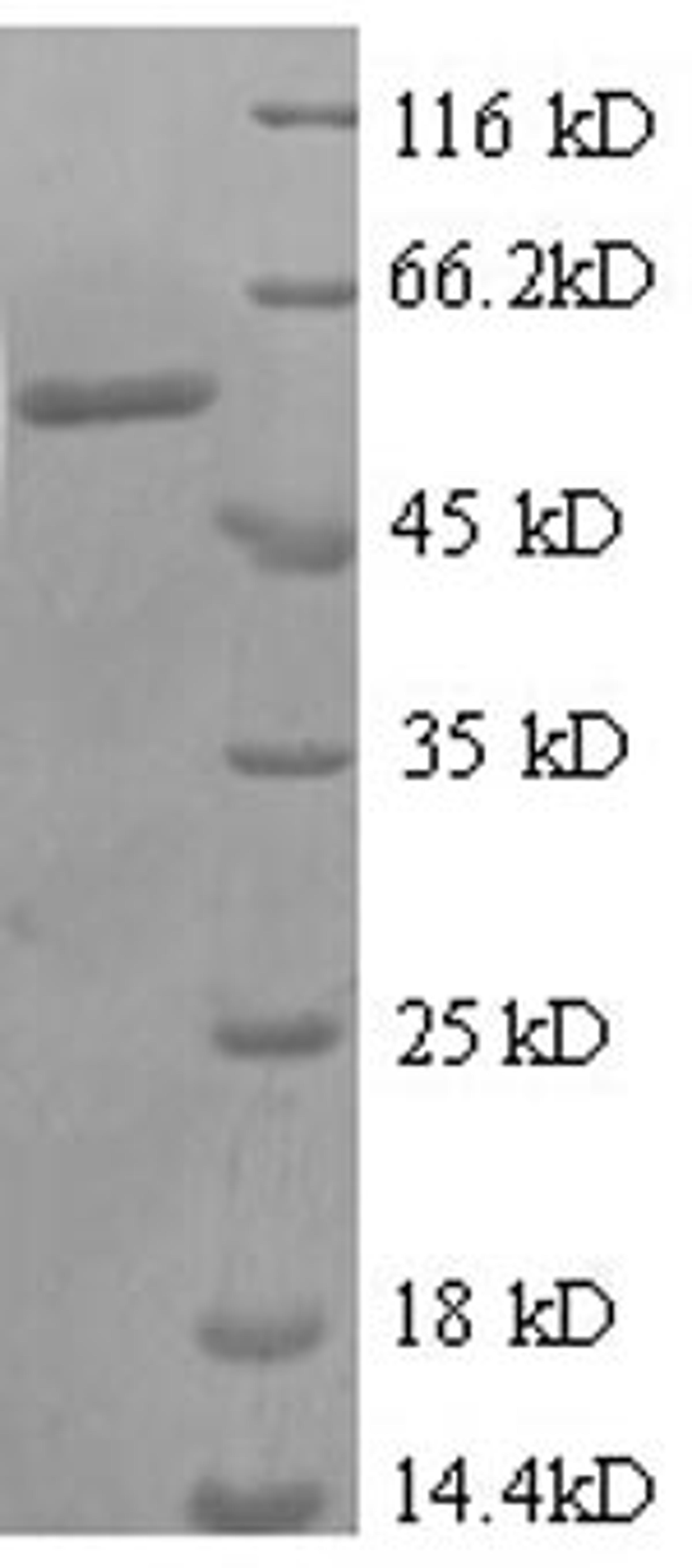 (Tris-Glycine gel) Discontinuous SDS-PAGE (reduced) with 5% enrichment gel and 15% separation gel.