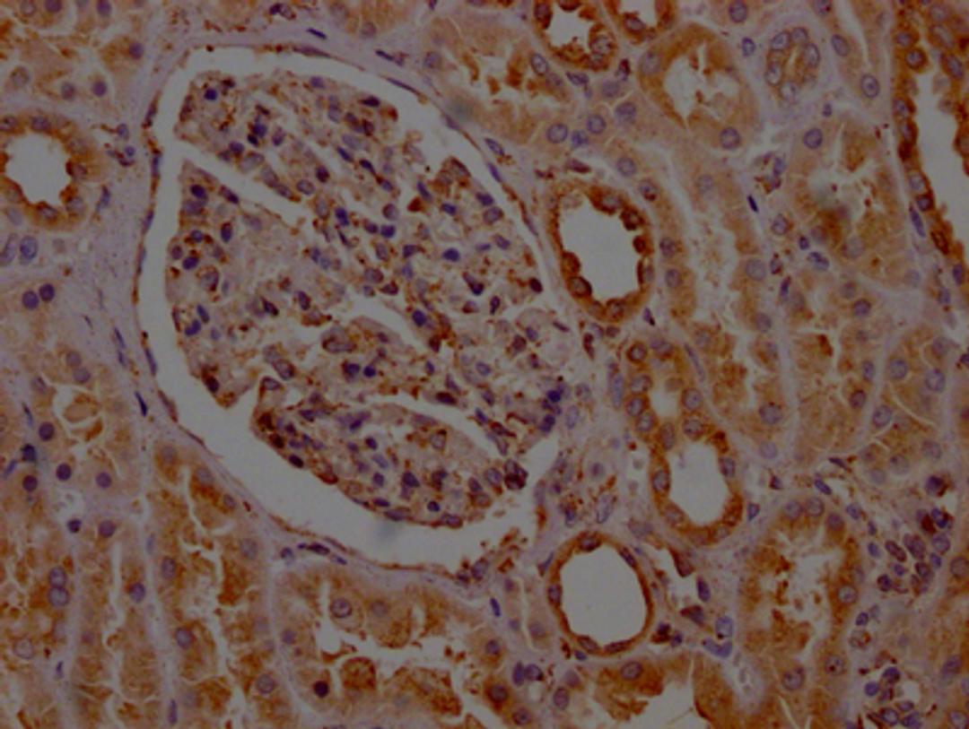 IHC image of CSB-RA585843A0HU diluted at 1:100 and staining in paraffin-embedded human kidney tissue performed on a Leica BondTM system. After dewaxing and hydration, antigen retrieval was mediated by high pressure in a citrate buffer (pH 6.0). Section was blocked with 10% normal goat serum 30min at RT. Then primary antibody (1% BSA) was incubated at 4℃ overnight. The primary is detected by a Goat anti-rabbit IgG polymer labeled by HRP and visualized using 0.05% DAB.