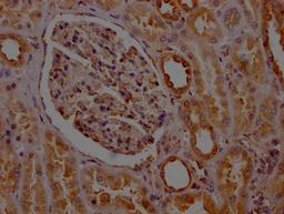 IHC image of CSB-RA585843A0HU diluted at 1:100 and staining in paraffin-embedded human kidney tissue performed on a Leica BondTM system. After dewaxing and hydration, antigen retrieval was mediated by high pressure in a citrate buffer (pH 6.0). Section was blocked with 10% normal goat serum 30min at RT. Then primary antibody (1% BSA) was incubated at 4℃ overnight. The primary is detected by a Goat anti-rabbit IgG polymer labeled by HRP and visualized using 0.05% DAB.