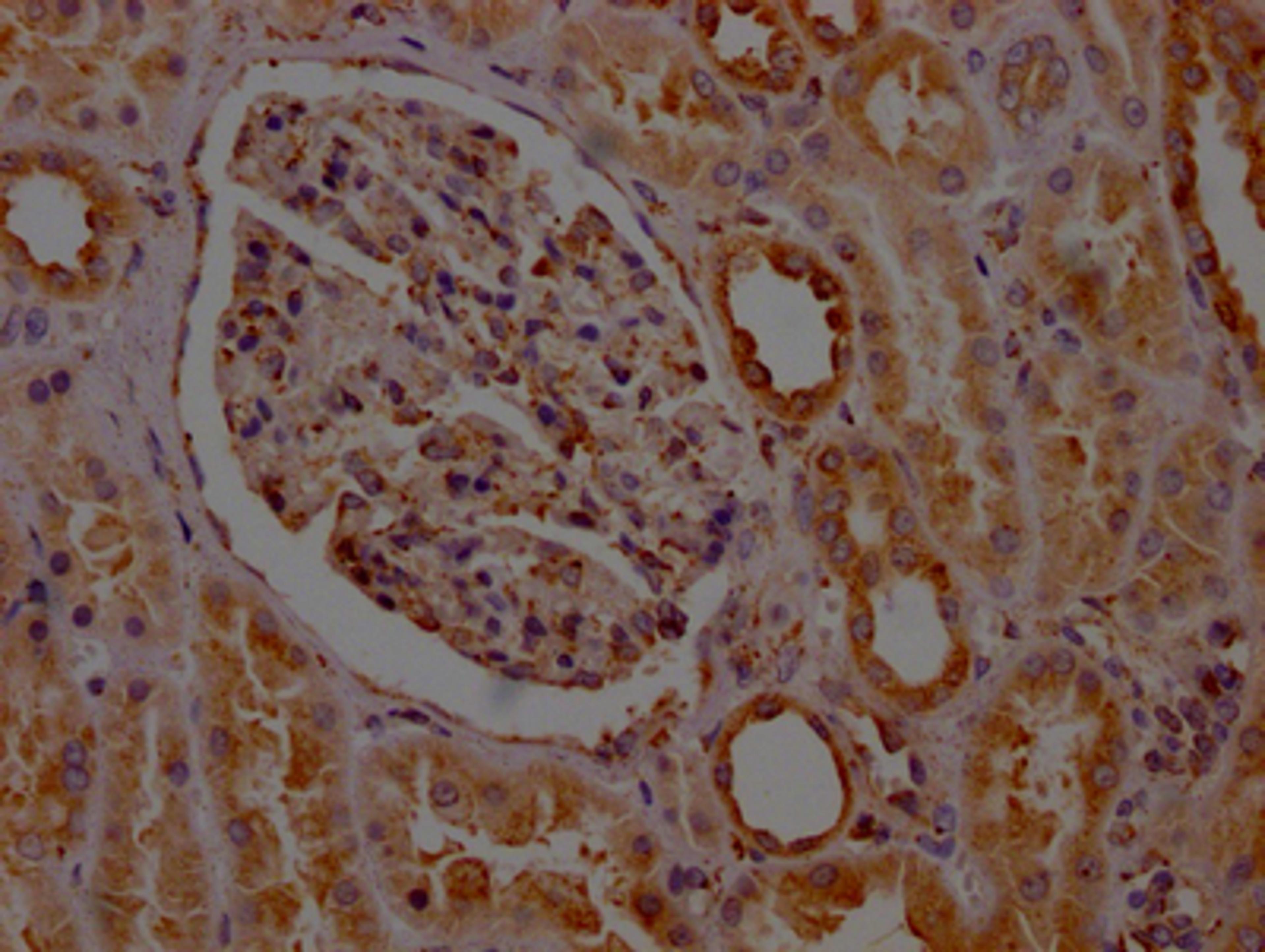 IHC image of CSB-RA585843A0HU diluted at 1:100 and staining in paraffin-embedded human kidney tissue performed on a Leica BondTM system. After dewaxing and hydration, antigen retrieval was mediated by high pressure in a citrate buffer (pH 6.0). Section was blocked with 10% normal goat serum 30min at RT. Then primary antibody (1% BSA) was incubated at 4℃ overnight. The primary is detected by a Goat anti-rabbit IgG polymer labeled by HRP and visualized using 0.05% DAB.