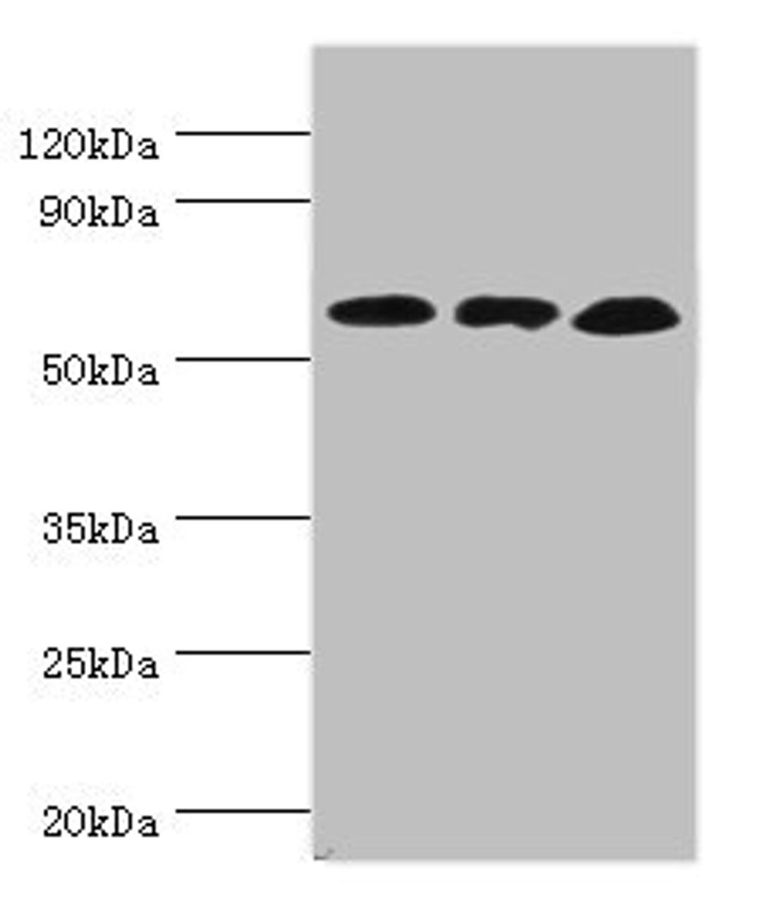Western blot. All lanes: Glutamate dehydrogenase 2, mitochondrial antibody at 4ug/ml. Lane 1: Mouse brain tissue. Lane 2: 293T whole cell lysate. Lane 3: Rat brain tissue. Secondary. Goat polyclonal to rabbit IgG at 1/10000 dilution. Predicted band size: 61 kDa. Observed band size: 61 kDa. 
