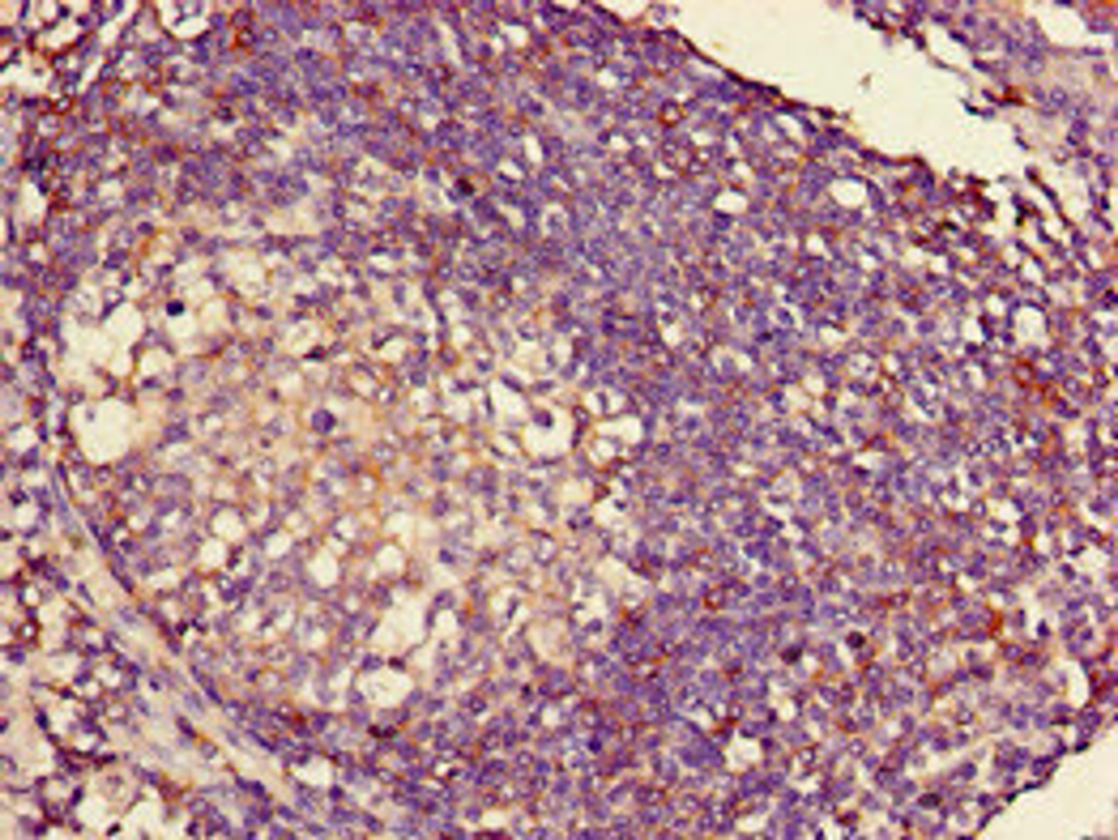 Immunohistochemistry of paraffin-embedded human lymph node tissue using CSB-PA15099D0Rb at dilution of 1:100