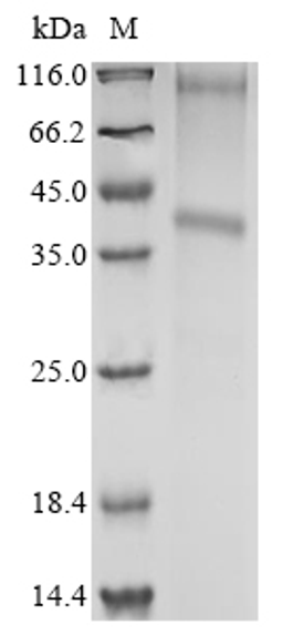 (Tris-Glycine gel) Discontinuous SDS-PAGE (reduced) with 5% enrichment gel and 15% separation gel.