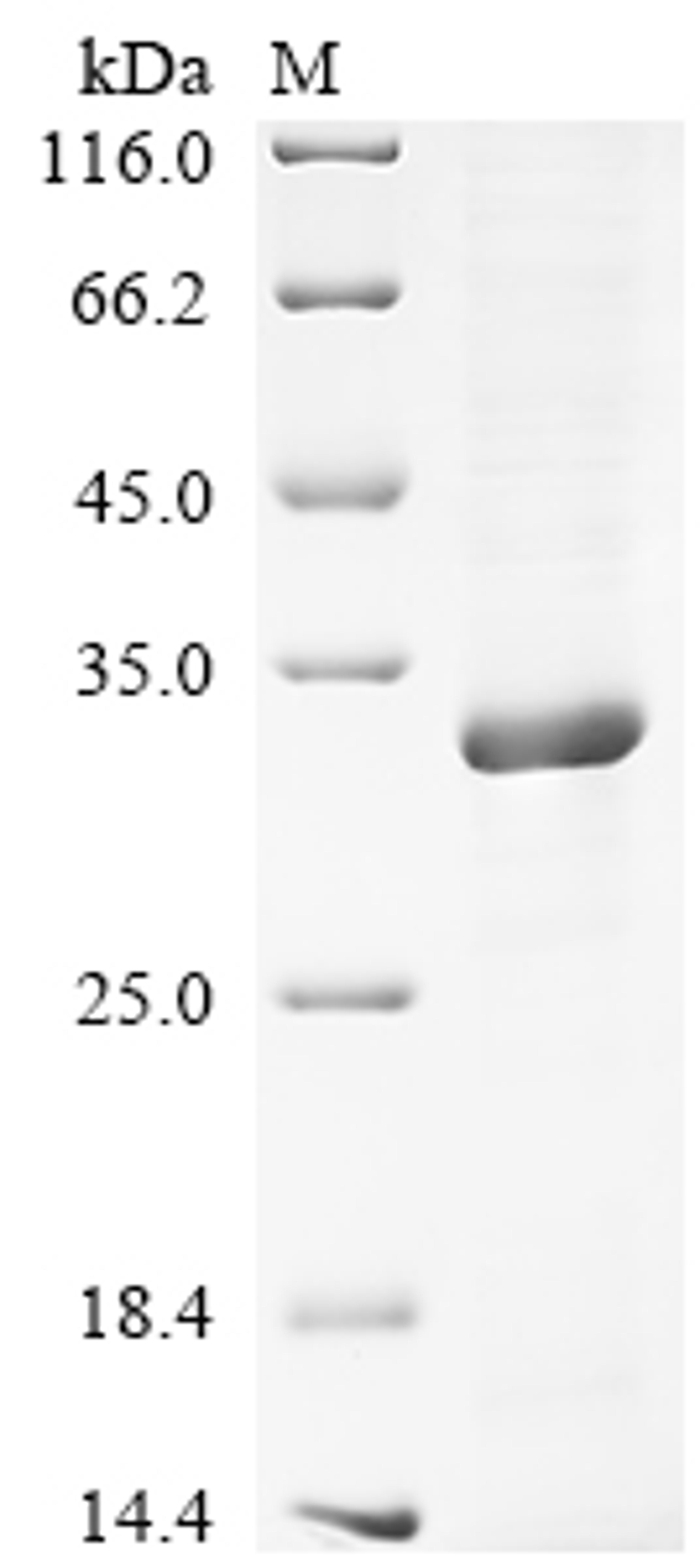 (Tris-Glycine gel) Discontinuous SDS-PAGE (reduced) with 5% enrichment gel and 15% separation gel.