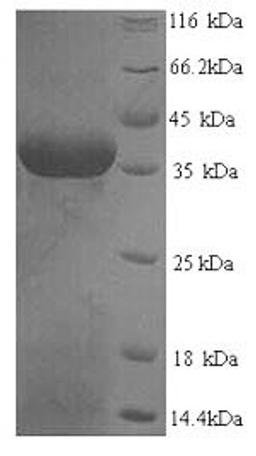 (Tris-Glycine gel) Discontinuous SDS-PAGE (reduced) with 5% enrichment gel and 15% separation gel.