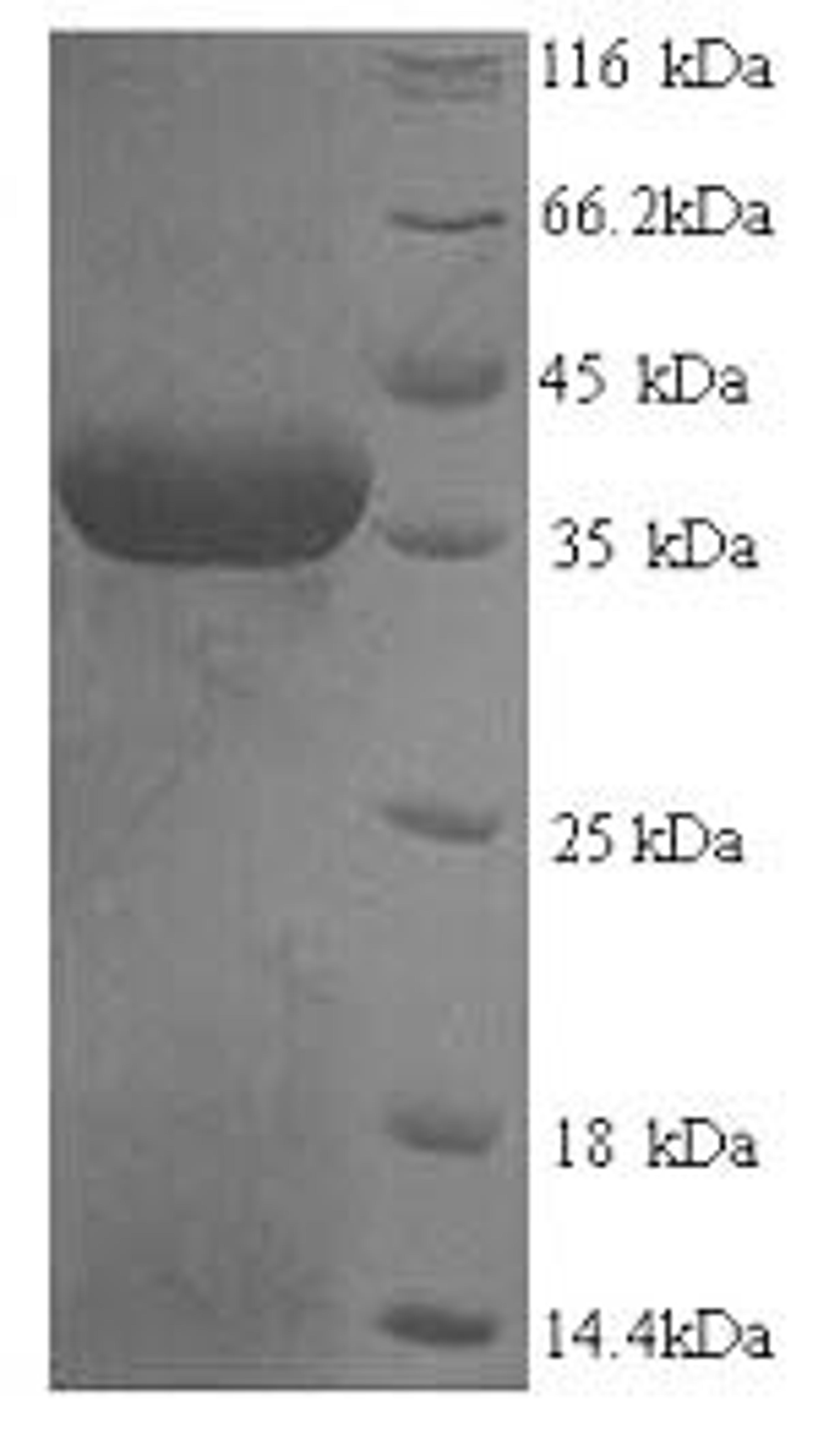 (Tris-Glycine gel) Discontinuous SDS-PAGE (reduced) with 5% enrichment gel and 15% separation gel.