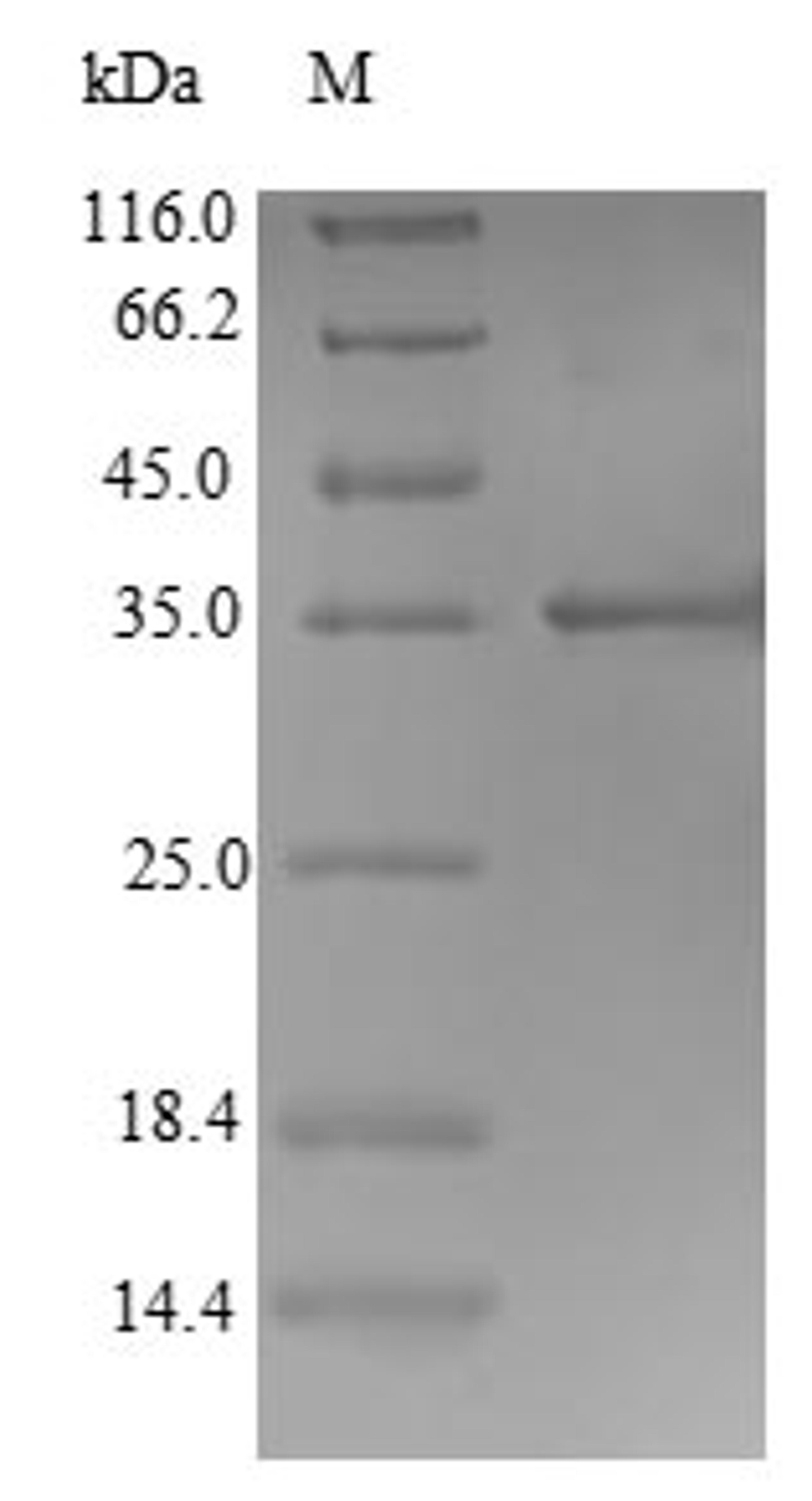 (Tris-Glycine gel) Discontinuous SDS-PAGE (reduced) with 5% enrichment gel and 15% separation gel.