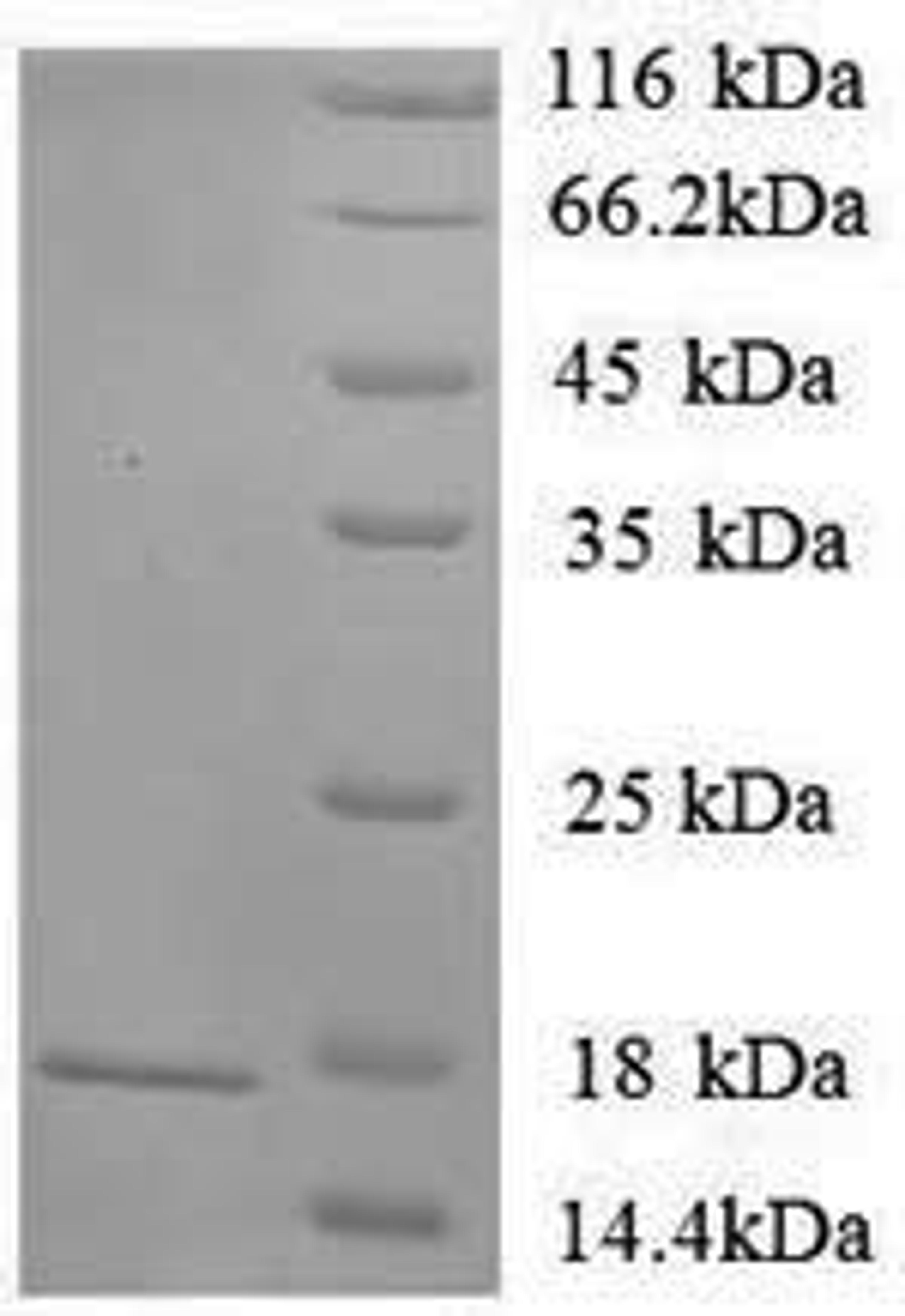(Tris-Glycine gel) Discontinuous SDS-PAGE (reduced) with 5% enrichment gel and 15% separation gel.