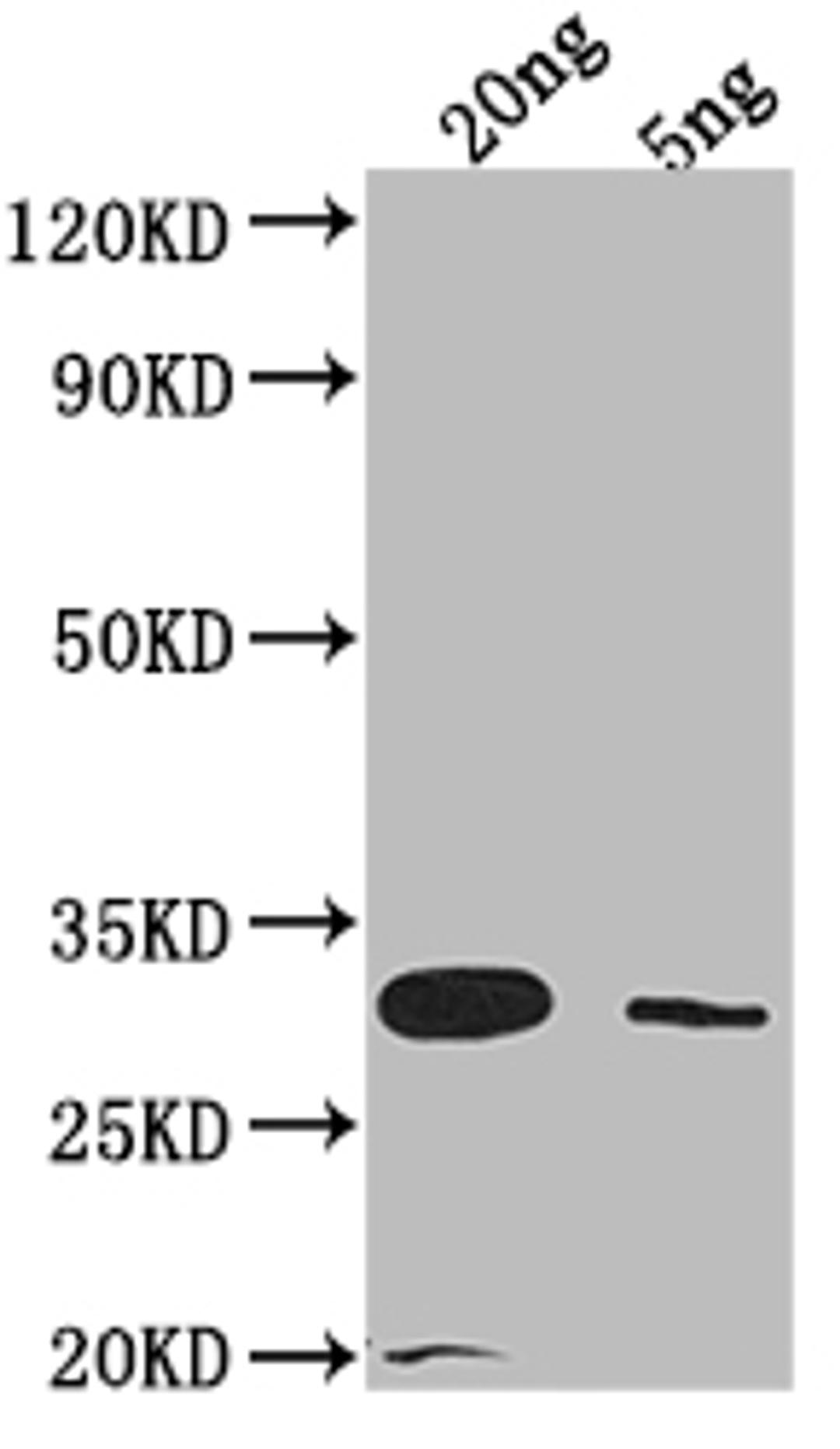 Western Blot. Positive WB detected in Recombinant protein. All lanes: LAMB antibody at 1:2000. Secondary. Goat polyclonal to rabbit IgG at 1/50000 dilution. Predicted band size: 29.8 kDa. Observed band size: 31 kDa. 