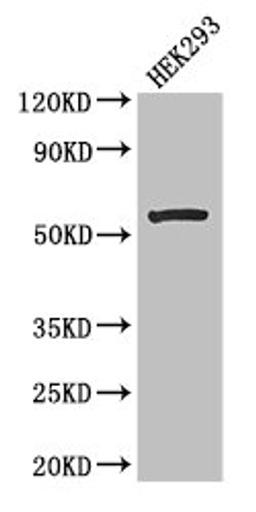 Western Blot. Positive WB detected in: HEK293 whole cell lysate. All lanes: MLYCD antibody at 2.7µg/ml. Secondary. Goat polyclonal to rabbit IgG at 1/50000 dilution. Predicted band size: 56, 51 kDa. Observed band size: 56 kDa