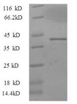 (Tris-Glycine gel) Discontinuous SDS-PAGE (reduced) with 5% enrichment gel and 15% separation gel.
