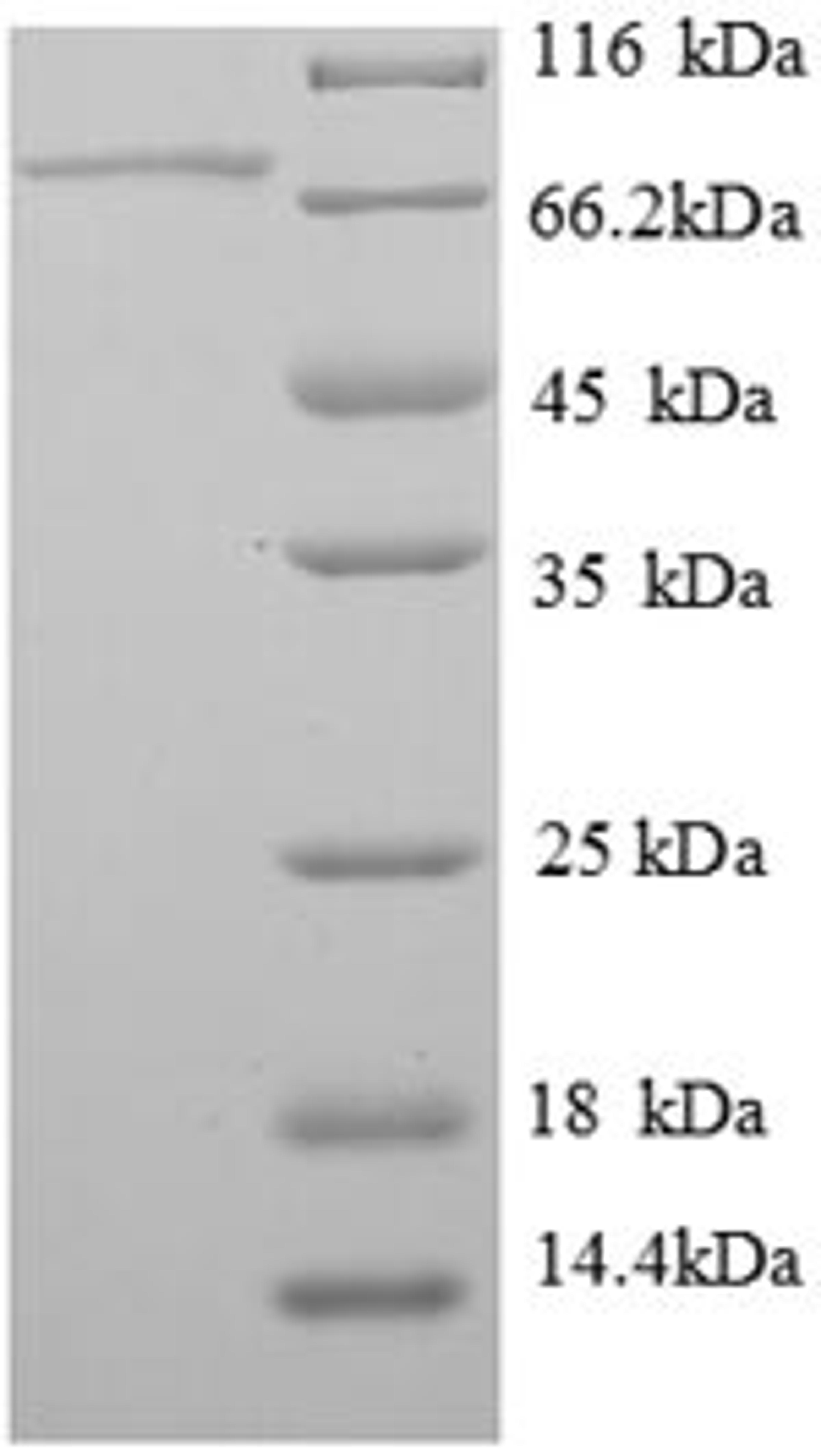 (Tris-Glycine gel) Discontinuous SDS-PAGE (reduced) with 5% enrichment gel and 15% separation gel.