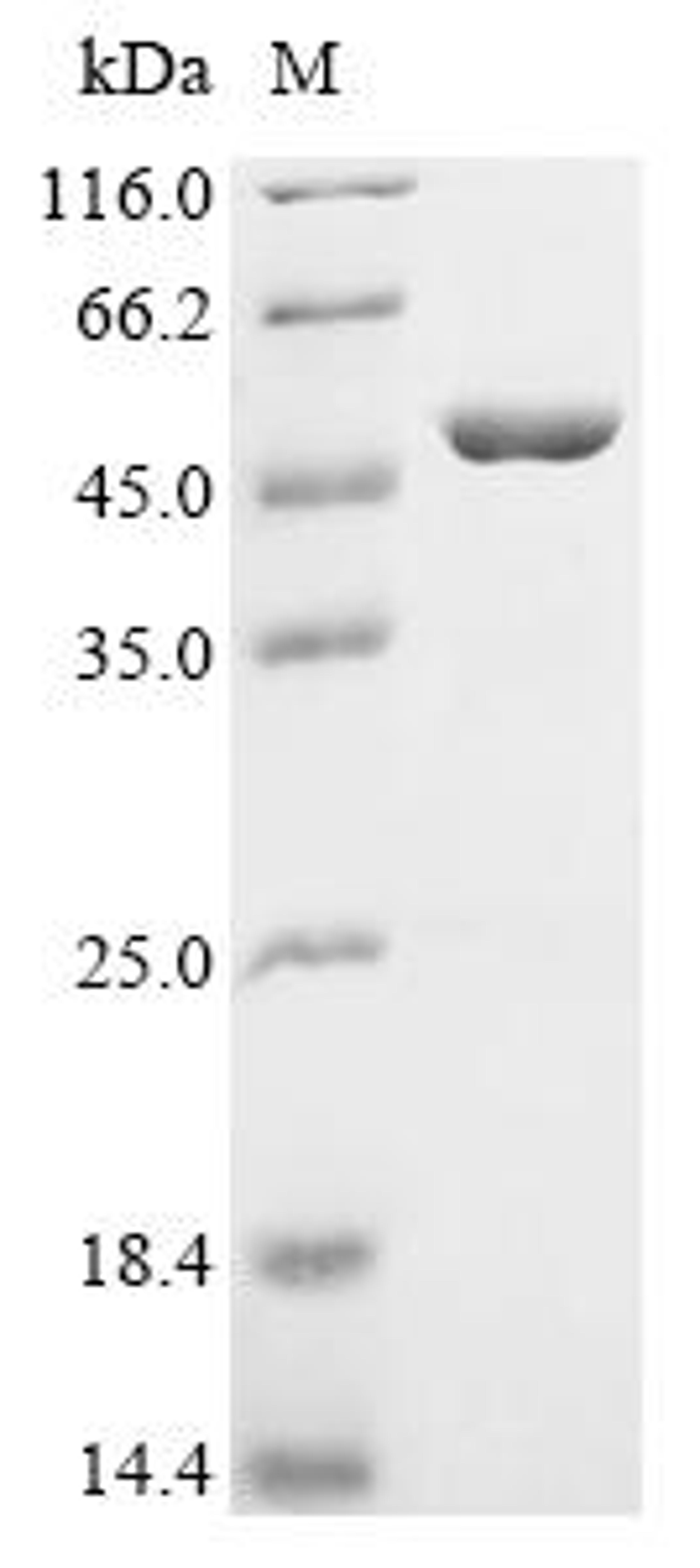 (Tris-Glycine gel) Discontinuous SDS-PAGE (reduced) with 5% enrichment gel and 15% separation gel.