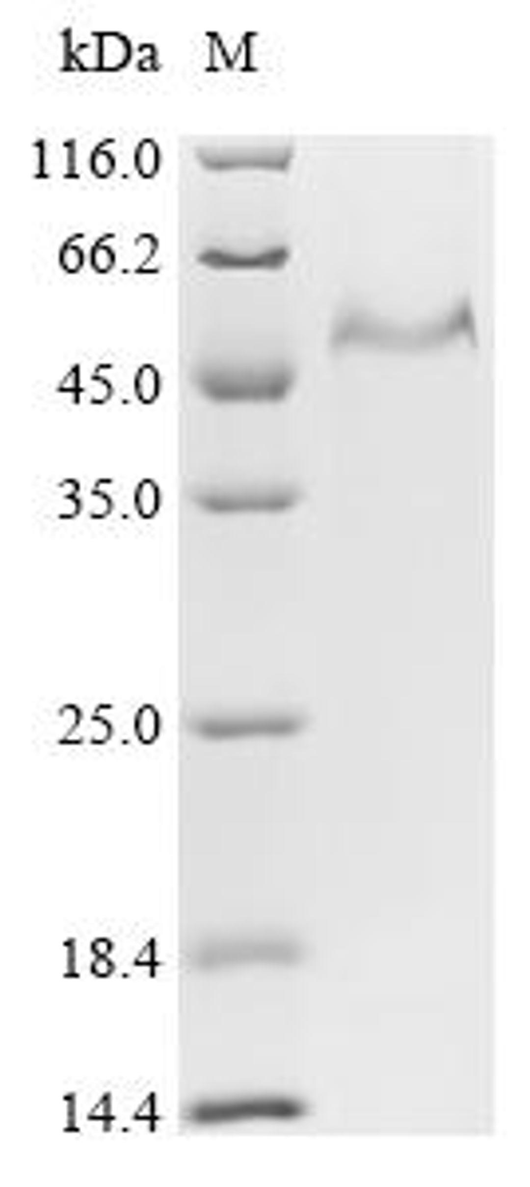 (Tris-Glycine gel) Discontinuous SDS-PAGE (reduced) with 5% enrichment gel and 15% separation gel.