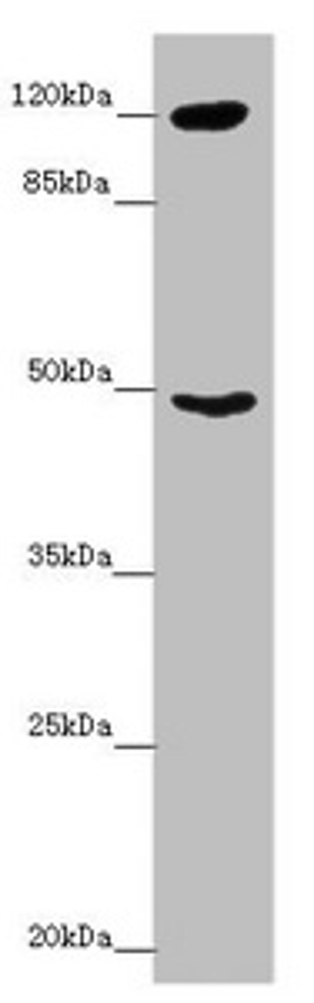 Western blot. All lanes: INPP4A antibody at 8.79 ug/ml + Mouse brain tissue. Secondary. Goat polyclonal to rabbit IgG at 1/10000 dilution. Predicted band size: 110, 106, 108 kDa. Observed band size: 110, 48 kDa. 