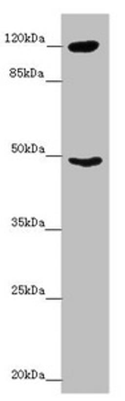 Western blot. All lanes: INPP4A antibody at 8.79 ug/ml + Mouse brain tissue. Secondary. Goat polyclonal to rabbit IgG at 1/10000 dilution. Predicted band size: 110, 106, 108 kDa. Observed band size: 110, 48 kDa. 