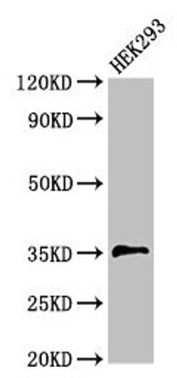 Western Blot. Positive WB detected in: HEK293 whole cell lysate. All lanes: PPT1 antibody at 3.5µg/ml. Secondary. Goat polyclonal to rabbit IgG at 1/50000 dilution. Predicted band size: 35, 24 kDa. Observed band size: 35 kDa
