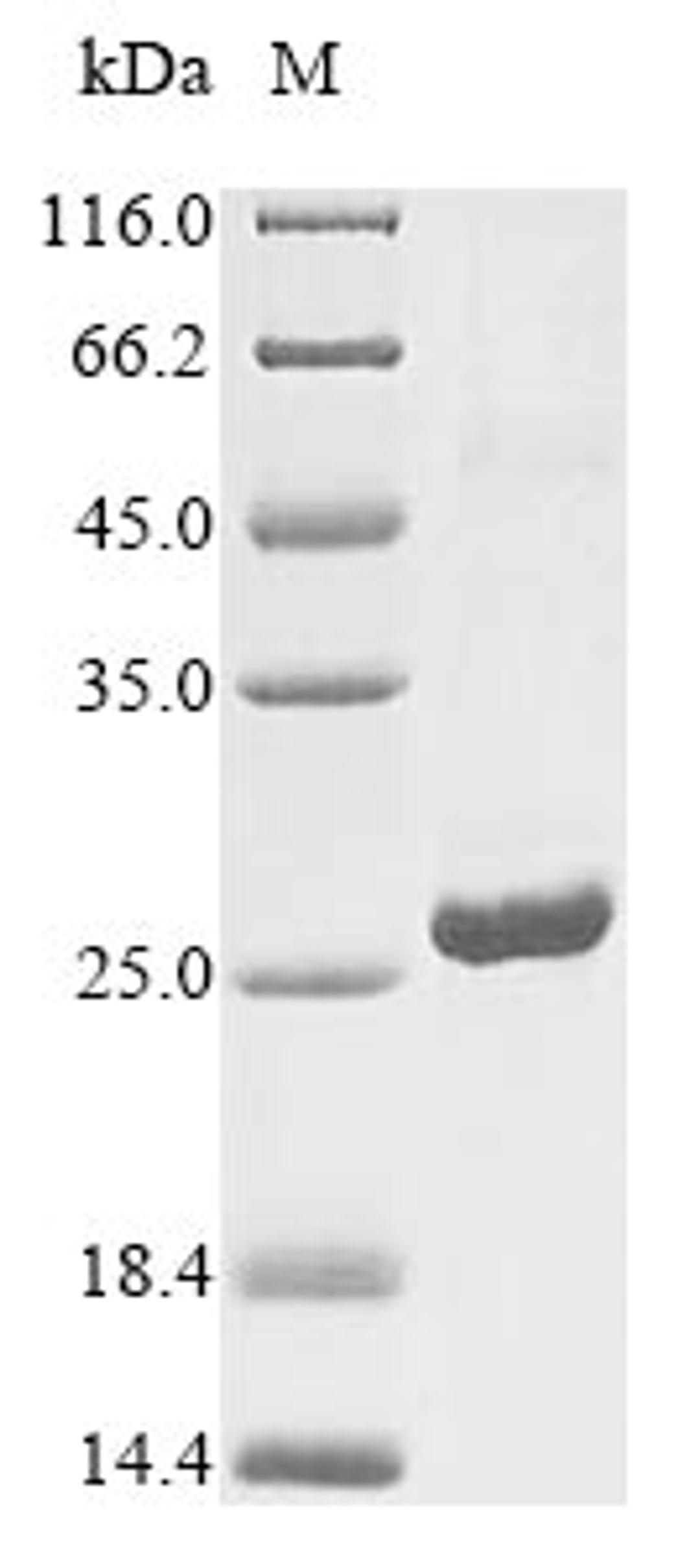 (Tris-Glycine gel) Discontinuous SDS-PAGE (reduced) with 5% enrichment gel and 15% separation gel.