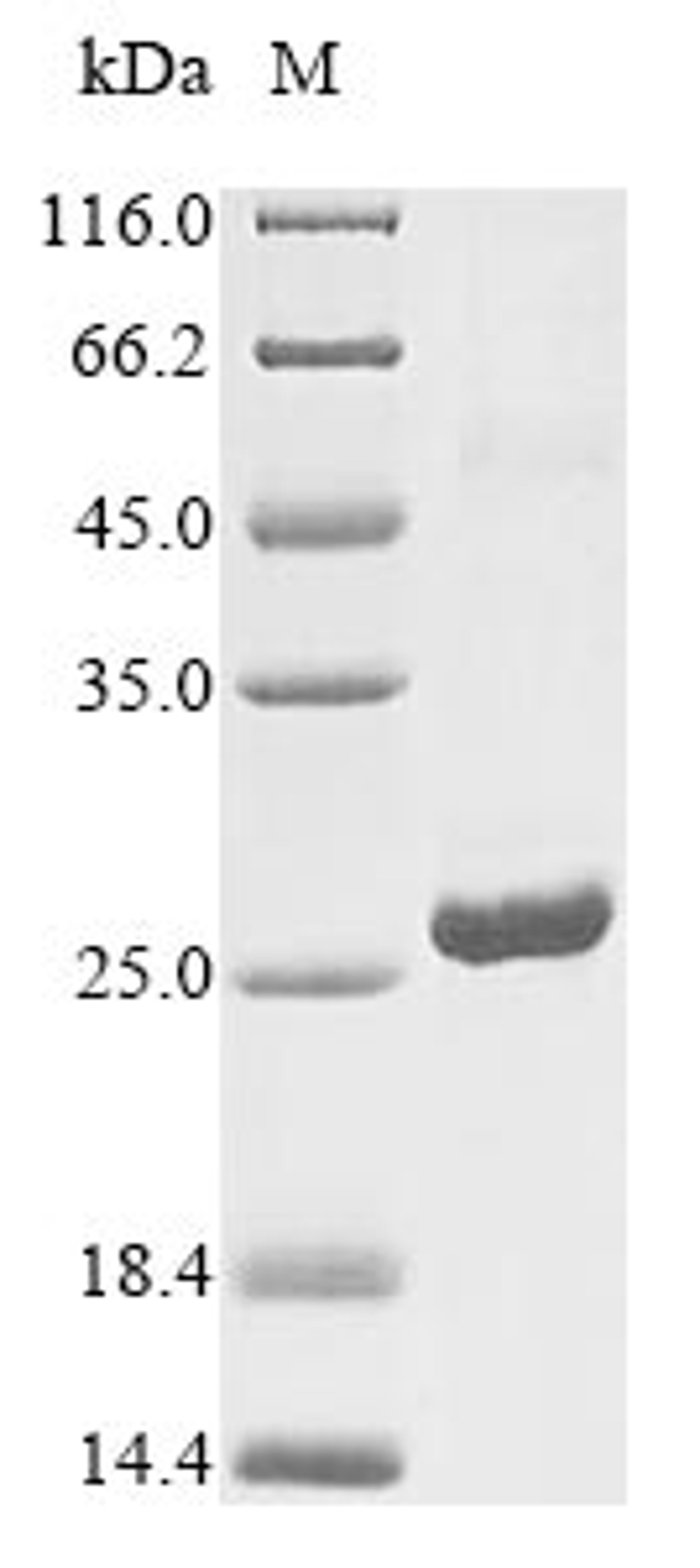 (Tris-Glycine gel) Discontinuous SDS-PAGE (reduced) with 5% enrichment gel and 15% separation gel.