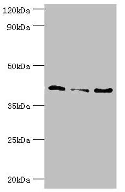Western blot. All lanes: Serpin B5 antibody at 10ug/ml. Lane 1: HepG2 whole cell lysate. Lane 2: Hela whole cell lysate. Lane 3: A431 whole cell lysate. Secondary. Goat polyclonal to rabbit IgG at 1/10000 dilution. Predicted band size: 43, 26 kDa. Observed band size: 43 kDa. 