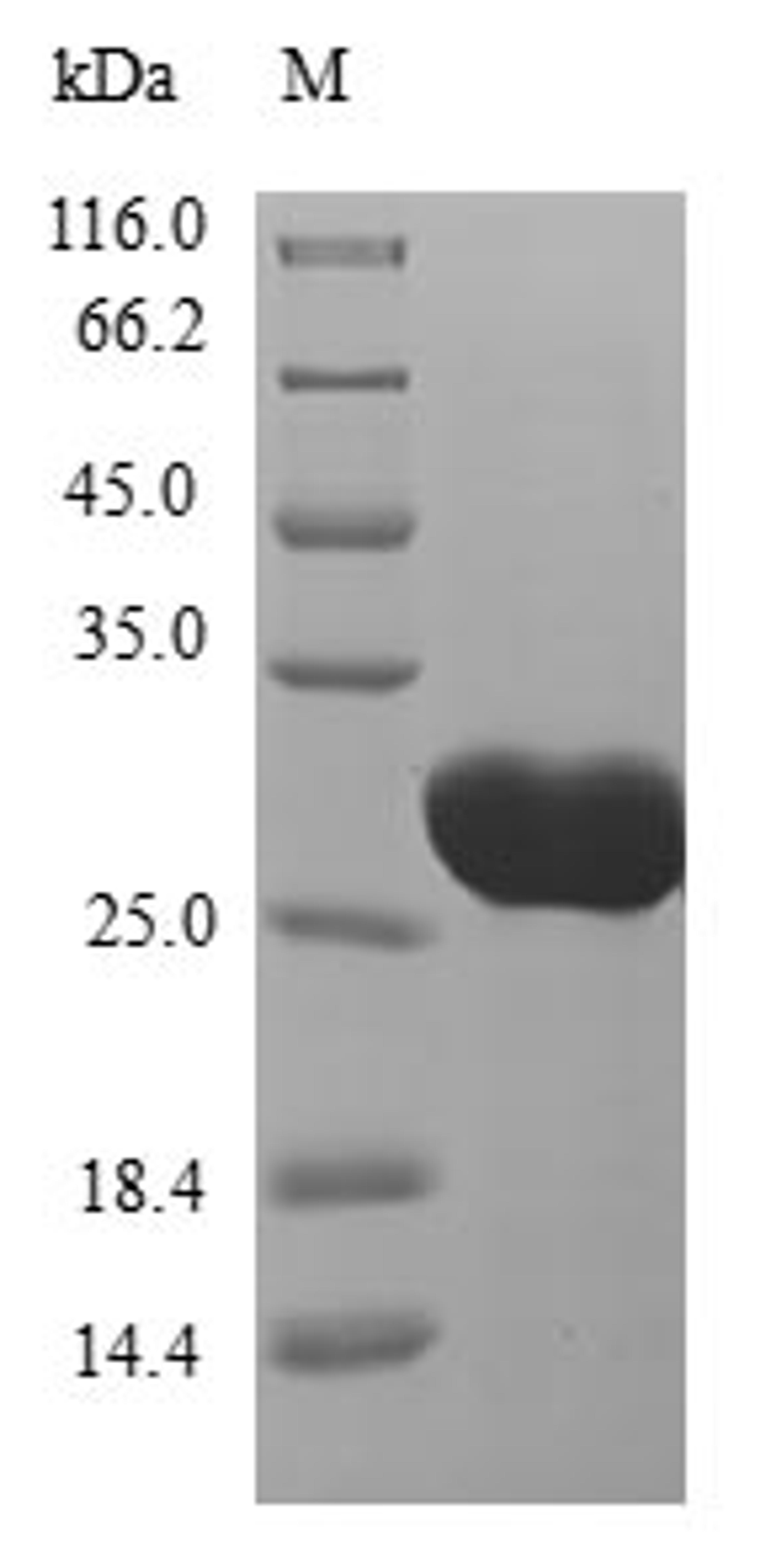 (Tris-Glycine gel) Discontinuous SDS-PAGE (reduced) with 5% enrichment gel and 15% separation gel.