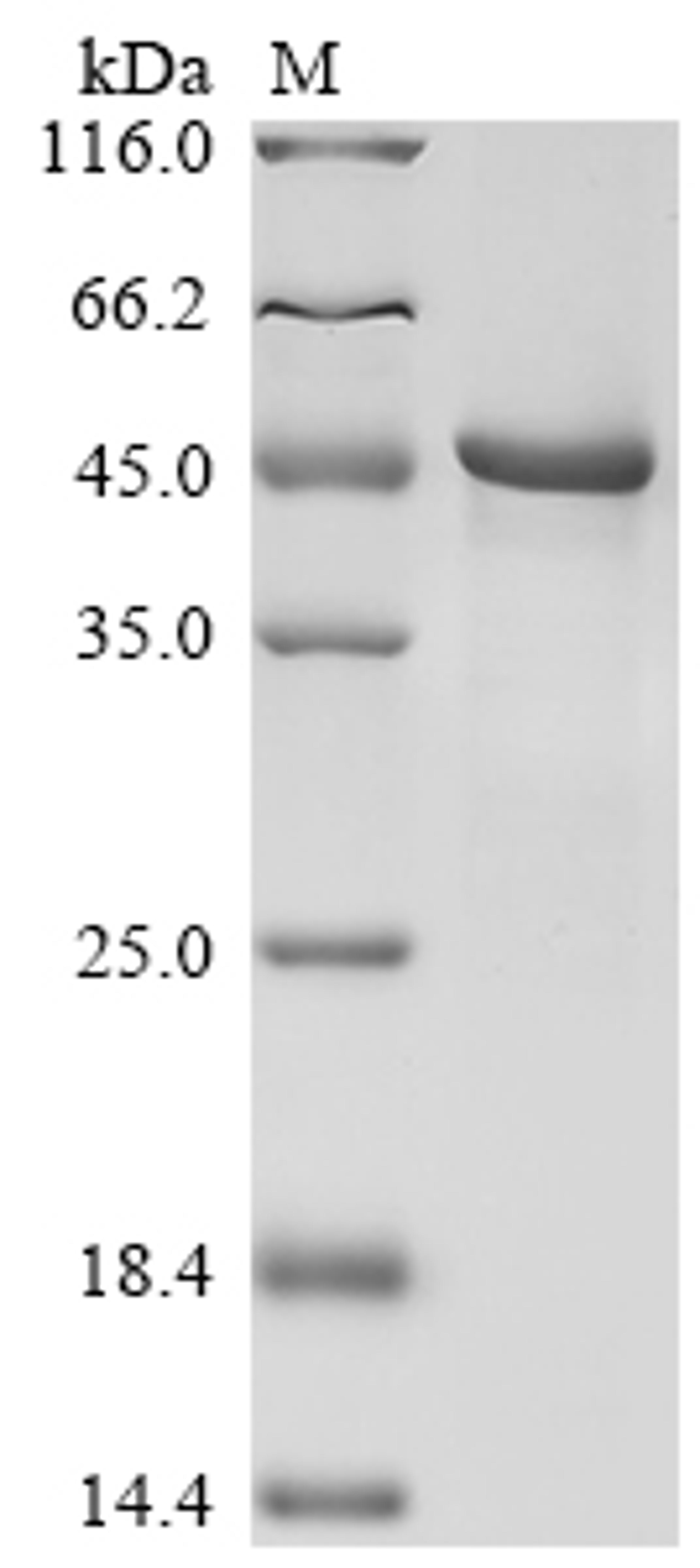 (Tris-Glycine gel) Discontinuous SDS-PAGE (reduced) with 5% enrichment gel and 15% separation gel.