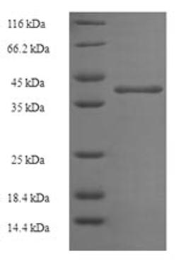 (Tris-Glycine gel) Discontinuous SDS-PAGE (reduced) with 5% enrichment gel and 15% separation gel.
