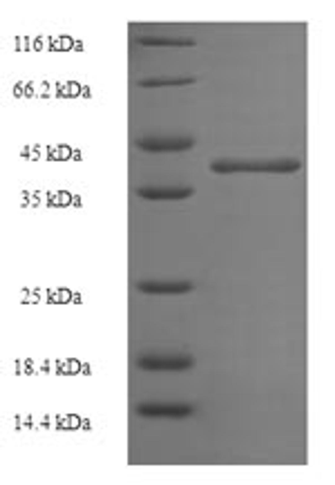 (Tris-Glycine gel) Discontinuous SDS-PAGE (reduced) with 5% enrichment gel and 15% separation gel.