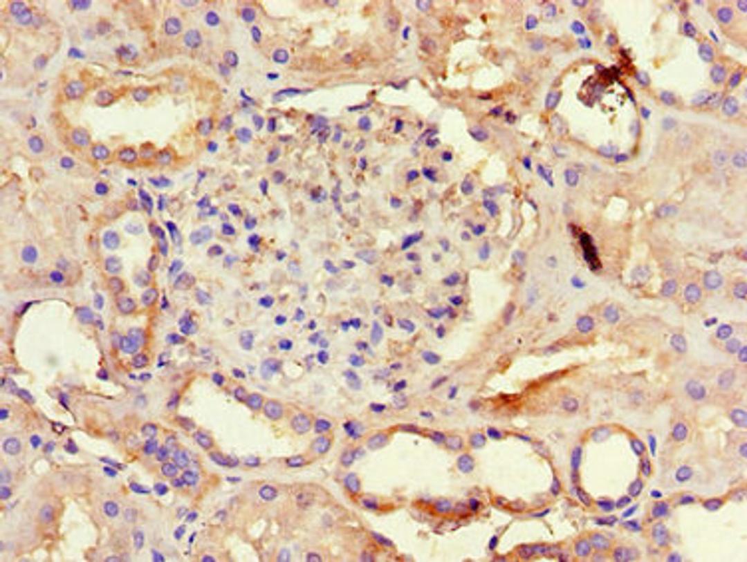Immunohistochemistry of paraffin-embedded human kidney tissue using CSB-PA13909A0Rb at dilution of 1:100