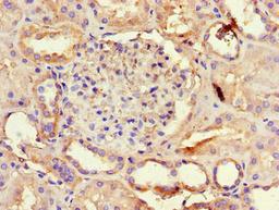 Immunohistochemistry of paraffin-embedded human kidney tissue using CSB-PA13909A0Rb at dilution of 1:100
