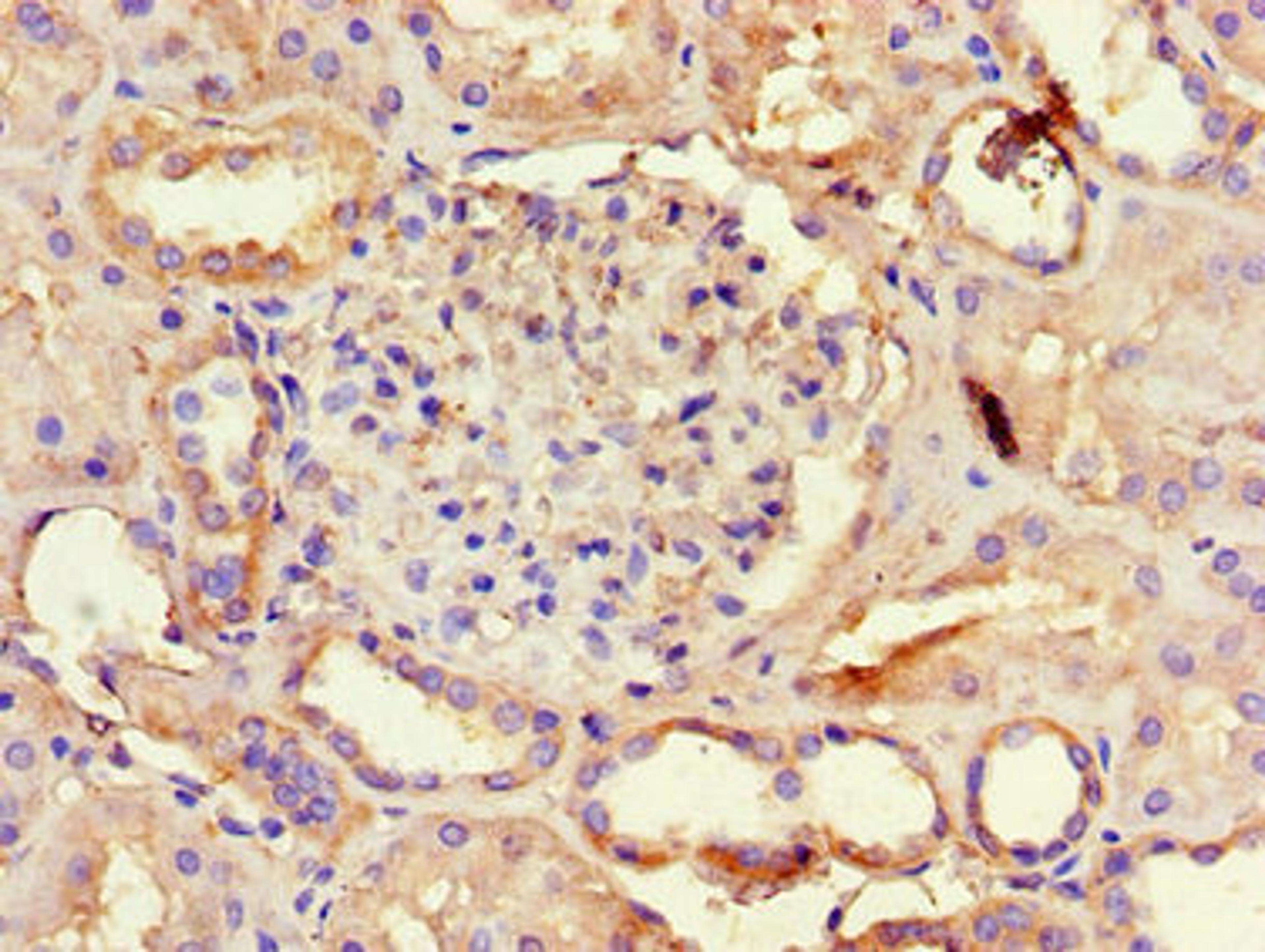Immunohistochemistry of paraffin-embedded human kidney tissue using CSB-PA13909A0Rb at dilution of 1:100
