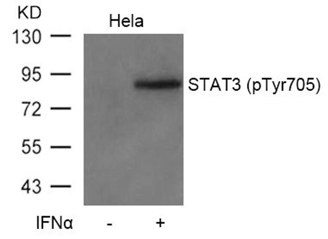 Western blot analysis of extracts from Hela cells untreated or treated with IFN a using STAT3(Phospho-Tyr705) Antibody.
