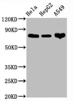 Western Blot. Positive WB detected in Hela whole cell lysate,HepG2 whole cell lysate,A549 whole cell lysate. All lanes CD44 antibody at 1.25μg/ml. Secondary. Goat polyclonal to rabbit IgG at 1/50000 dilution. Predicted band size: 82 KDa. Observed band size: 82 KDa. 