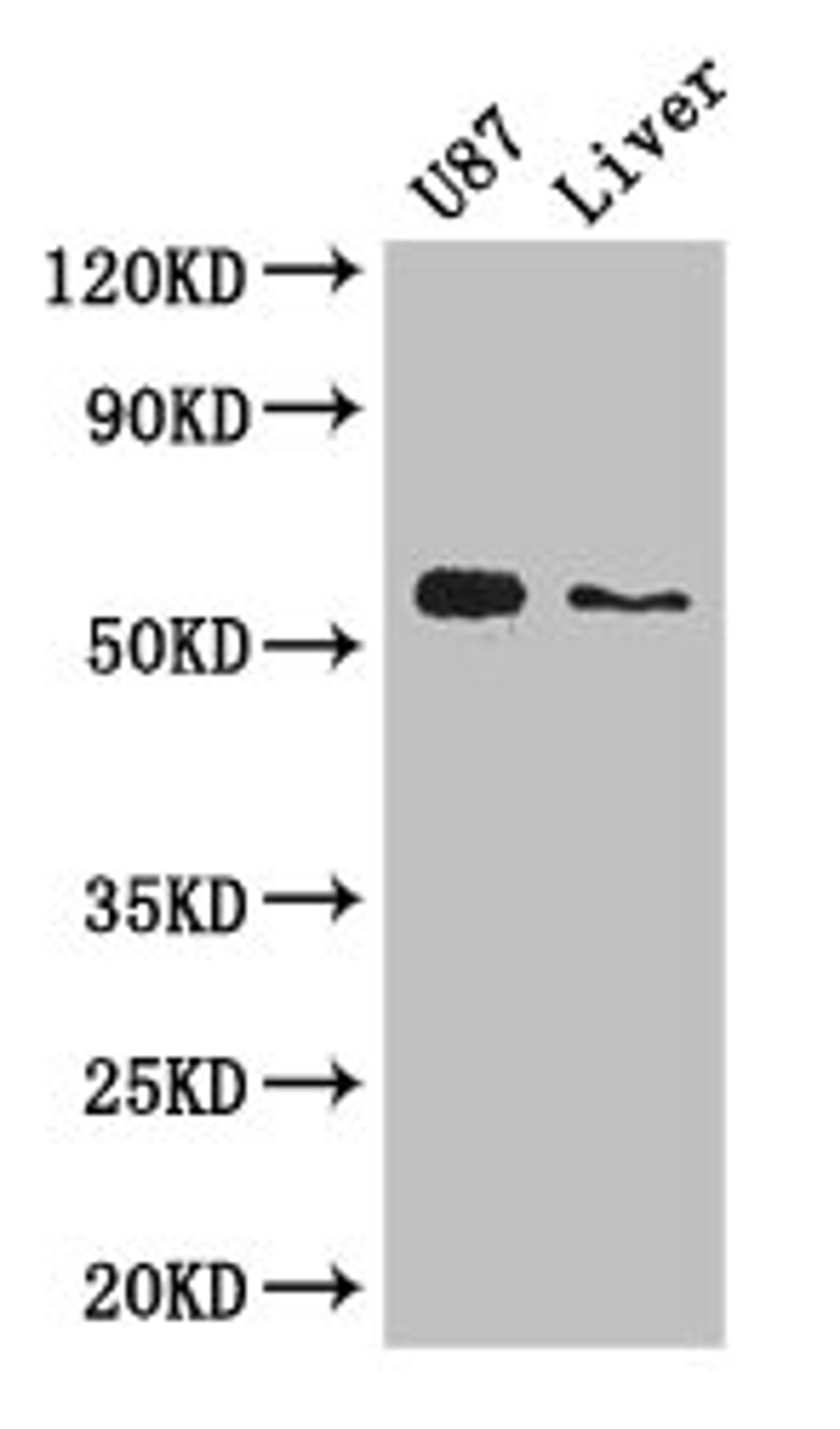 Western Blot. Positive WB detected in: U87 whole cell lysate, Mouse liver tissue. All lanes: ALDH1A3 antibody at 3ug/ml. Secondary. Goat polyclonal to rabbit IgG at 1/50000 dilution. Predicted band size: 57 kDa. Observed band size: 57 kDa. 