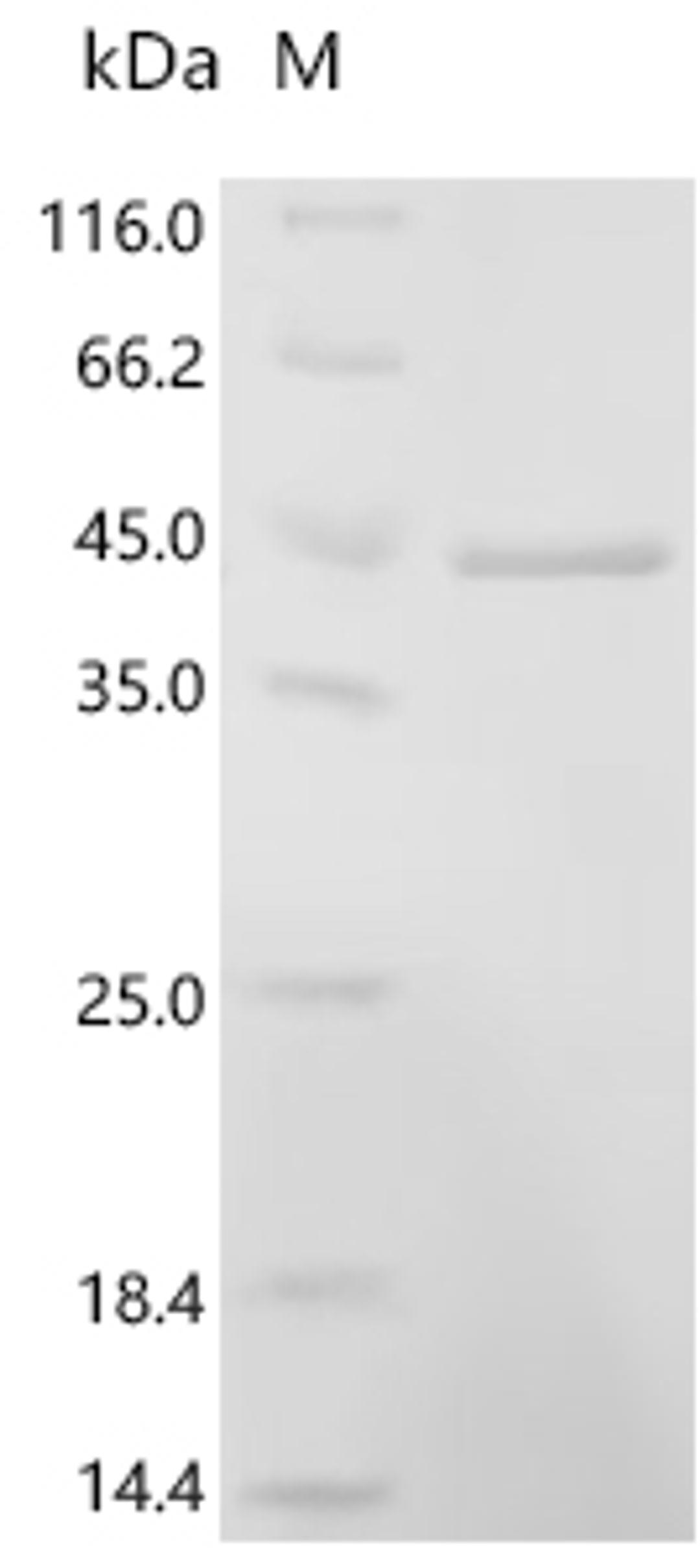 (Tris-Glycine gel) Discontinuous SDS-PAGE (reduced) with 5% enrichment gel and 15% separation gel.