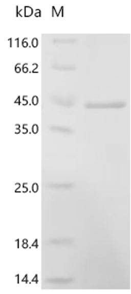 (Tris-Glycine gel) Discontinuous SDS-PAGE (reduced) with 5% enrichment gel and 15% separation gel.