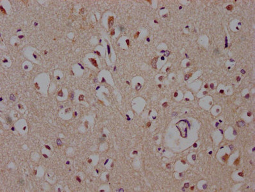 IHC image of CSB-PA873691LA01HU diluted at 1:600 and staining in paraffin-embedded human brain tissue performed on a Leica BondTM system. After dewaxing and hydration, antigen retrieval was mediated by high pressure in a citrate buffer (pH 6.0). Section was blocked with 10% normal goat serum 30min at RT. Then primary antibody (1% BSA) was incubated at 4°C overnight. The primary is detected by a biotinylated secondary antibody and visualized using an HRP conjugated SP system.