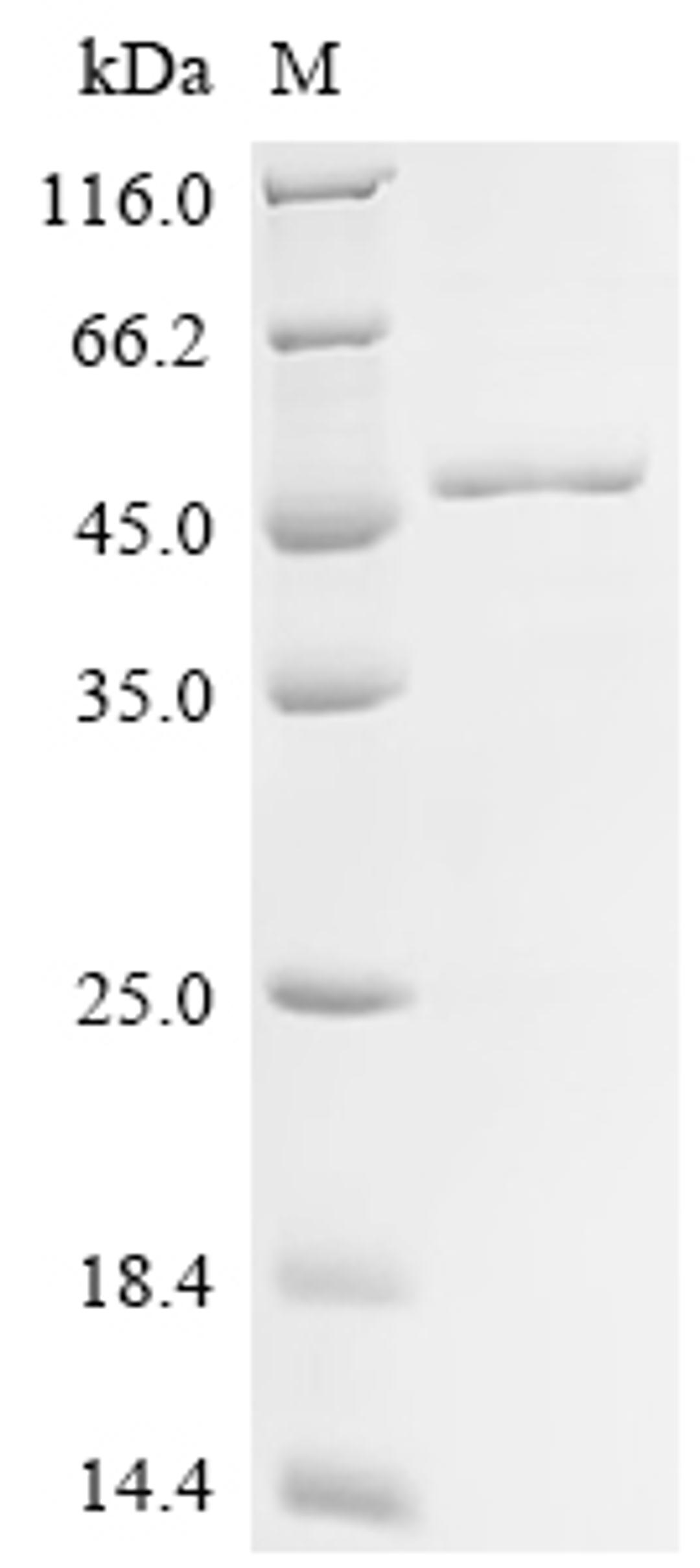 (Tris-Glycine gel) Discontinuous SDS-PAGE (reduced) with 5% enrichment gel and 15% separation gel.