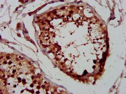 IHC image of CSB-PA026107LA01HU diluted at 1:400 and staining in paraffin-embedded human testis tissue performed on a Leica BondTM system. After dewaxing and hydration, antigen retrieval was mediated by high pressure in a citrate buffer (pH 6.0). Section was blocked with 10% normal goat serum 30min at RT. Then primary antibody (1% BSA) was incubated at 4&deg;C overnight. The primary is detected by a biotinylated secondary antibody and visualized using an HRP conjugated SP system.