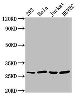 Western Blot. Positive WB detected in: 293 whole cell lysate, Hela whole cell lysate, Jurkat whole cell lysate, HUVEC whole cell lysate. All lanes: CACYBP antibody at 2.7ug/ml. Secondary. Goat polyclonal to rabbit IgG at 1/50000 dilution. Predicted band size: 27, 9, 22 kDa. Observed band size: 27 kDa. 