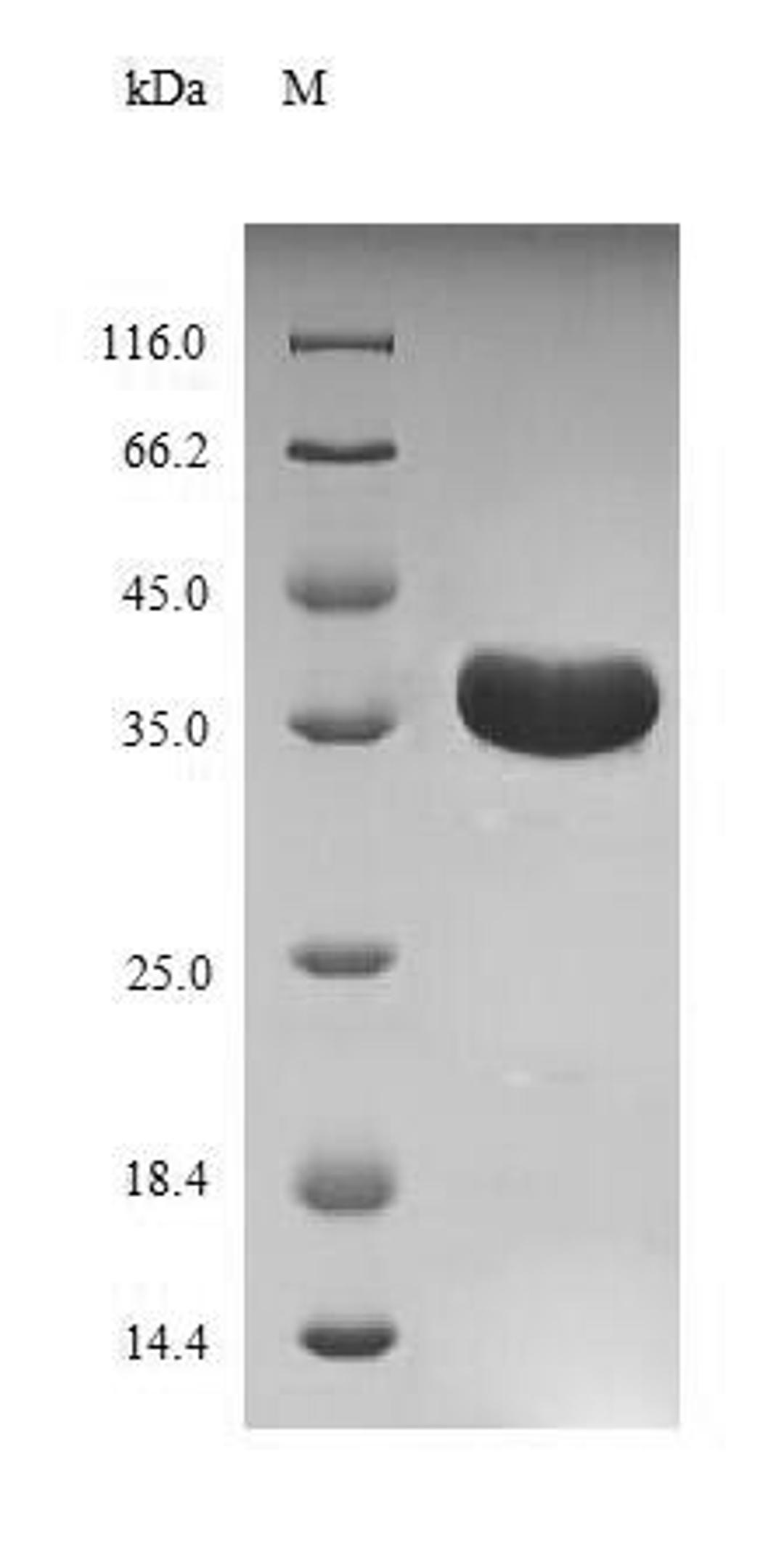 (Tris-Glycine gel) Discontinuous SDS-PAGE (reduced) with 5% enrichment gel and 15% separation gel.