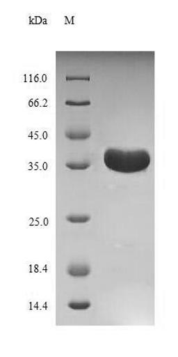 (Tris-Glycine gel) Discontinuous SDS-PAGE (reduced) with 5% enrichment gel and 15% separation gel.