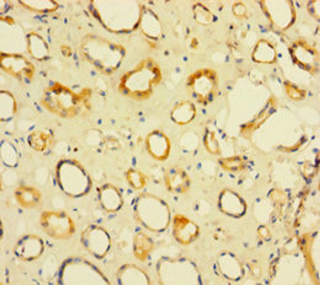 Immunohistochemistry of paraffin-embedded human kidney tissue using CSB-PA897077HA01HU at dilution of 1:100