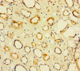 Immunohistochemistry of paraffin-embedded human kidney tissue using CSB-PA897077HA01HU at dilution of 1:100