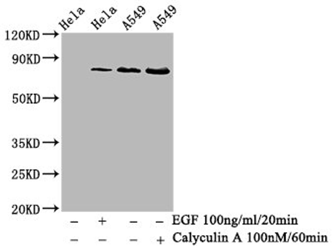 Western Blot. Positive WB detected in Hela whole cell lysate锛孉549 whole cell lysate(treated with Calyculin A or EGF). All lanes Phospho-PRKCA antibody at 0.68μg/ml. Secondary. Goat polyclonal to rabbit IgG at 1/50000 dilution. Predicted band size: 80 KDa. Observed band size: 80 KDa. 